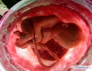 मानव भ्रूण विकास